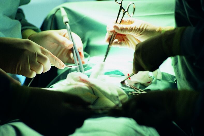 aumento chirurgico dello spessore del pene